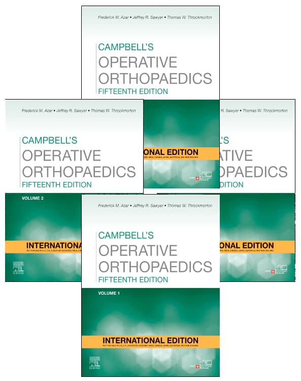 Campbells Operative Orthopaedics 15th IE/2026 (4 Vols)