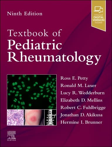 Textbook of Pediatric Rheumatology 9th/2027