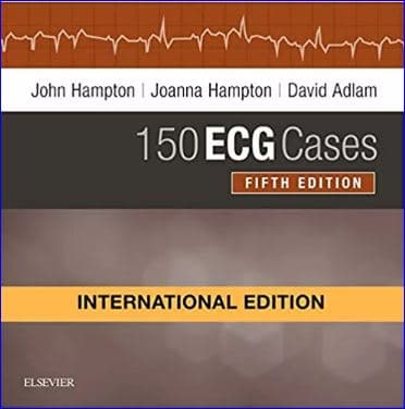 150 ECG Cases 5th/2019