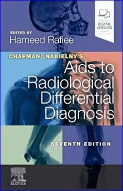 Chapman & Nakielny's Aids to Radiological Differential Diagnosis 7th/2019