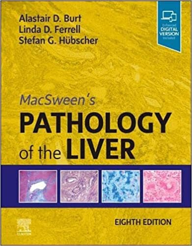 MacSween's Pathology of the Liver 8th/2023