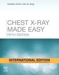 Chest X-ray Made Easy 5th/2022 (IE)