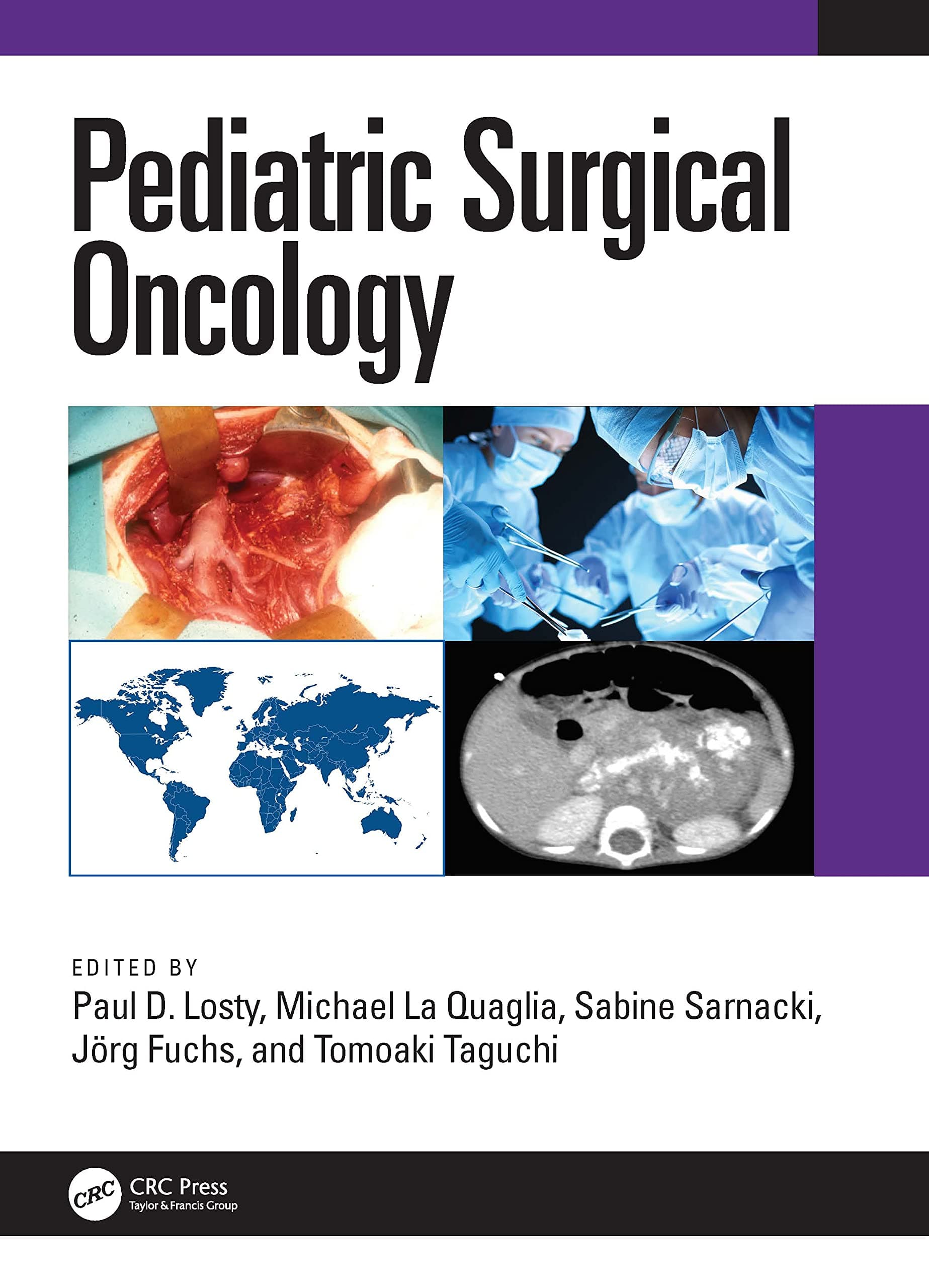 Pediatric Surgical Oncology 1st/2022