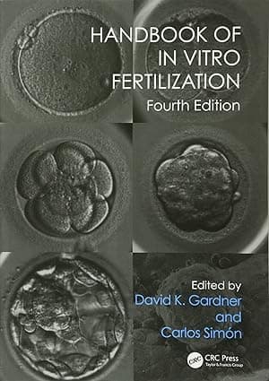 Handbook of In Vitro Fertilization 4th/2017