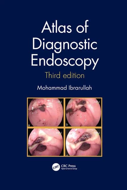 Atlas of Diagnostic Endoscopy 3rd/2021