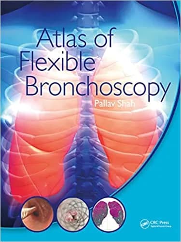 Atlas of Flexible Bronchoscopy 1st/2022