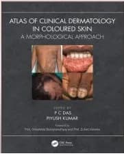 Atlas Of Clinical Dermatology In Coloured Skin 1st/2024