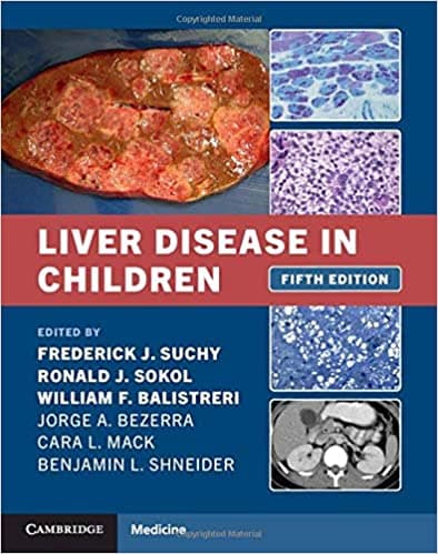 Liver Disease in Children 5th/2021
