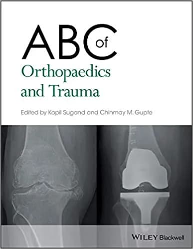 ABC Of Orthopaedics and Trauma 1st/2018