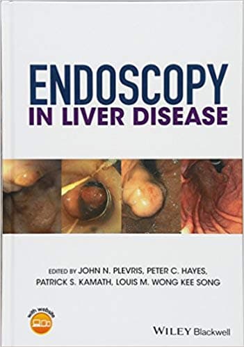 Endoscopy in Liver Disease 1st/2018