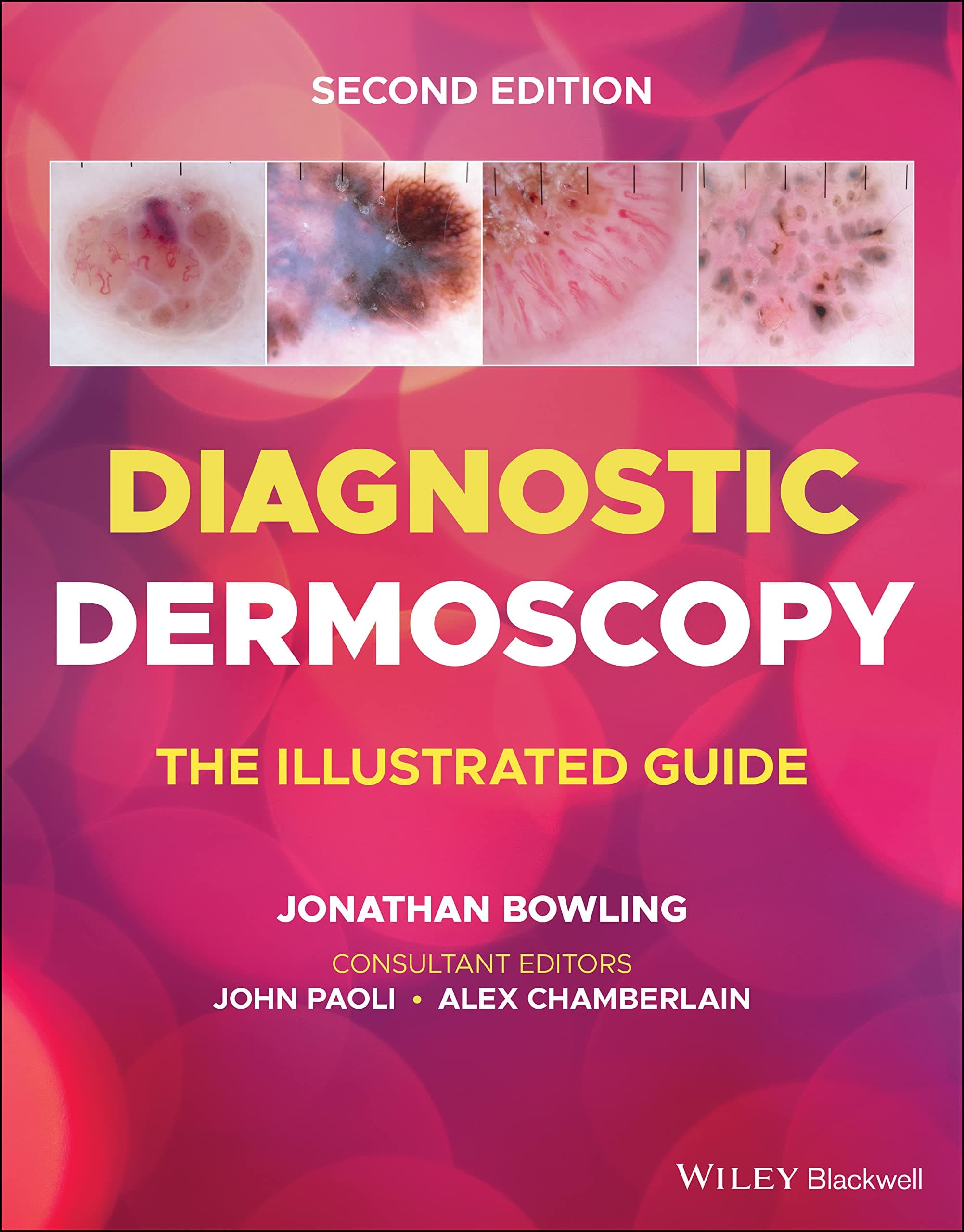 Diagnostic Dermoscopy: The Illustrated Guide 2nd/2022