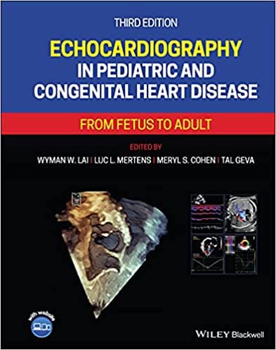 Echocardiography In Pediatric and Congenital Heart Disease 3rd/2022