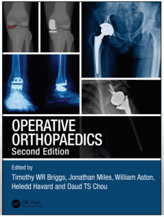 Operative Orthopaedics 2nd/2021