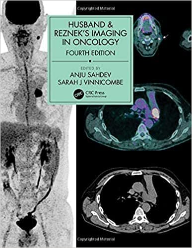Husband &amp; Reznek's Imaging in Oncology 4th/2020