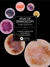 Atlas Of Dermoscopy 3rd/2023