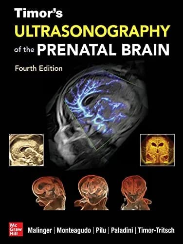 Timor's Ultrasonography of the Prenatal Brain 4th/2023