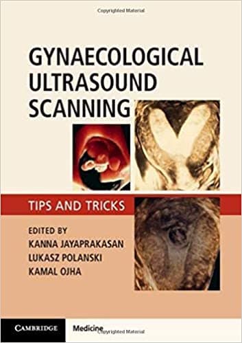 Gynaecological Ultrasound Scanning 1st/2020