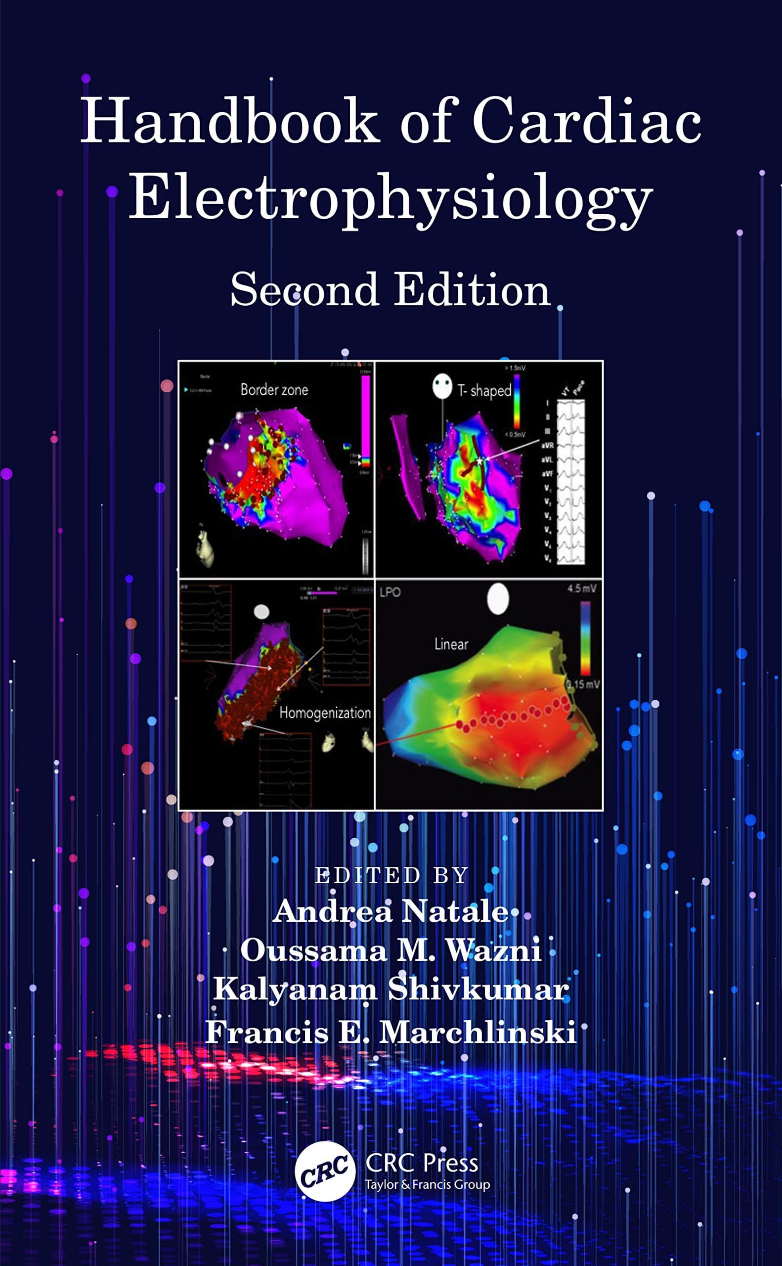 Handbook of Cardiac Electrophysiology 1st/2020