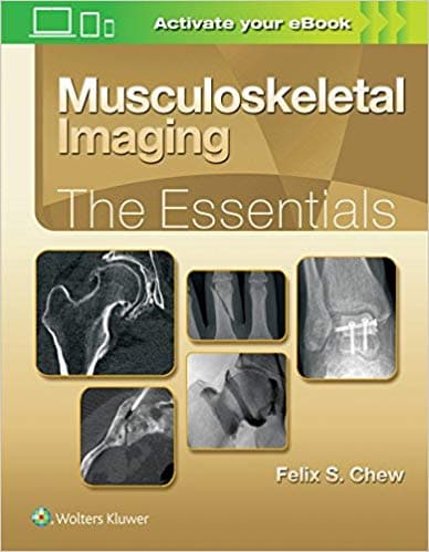 Musculoskeletal Imaging: The Essentials 1st/2019