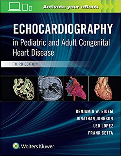 Echocardiography in Pediatric and Adult Congenital Heart Disease 3rd/2021
