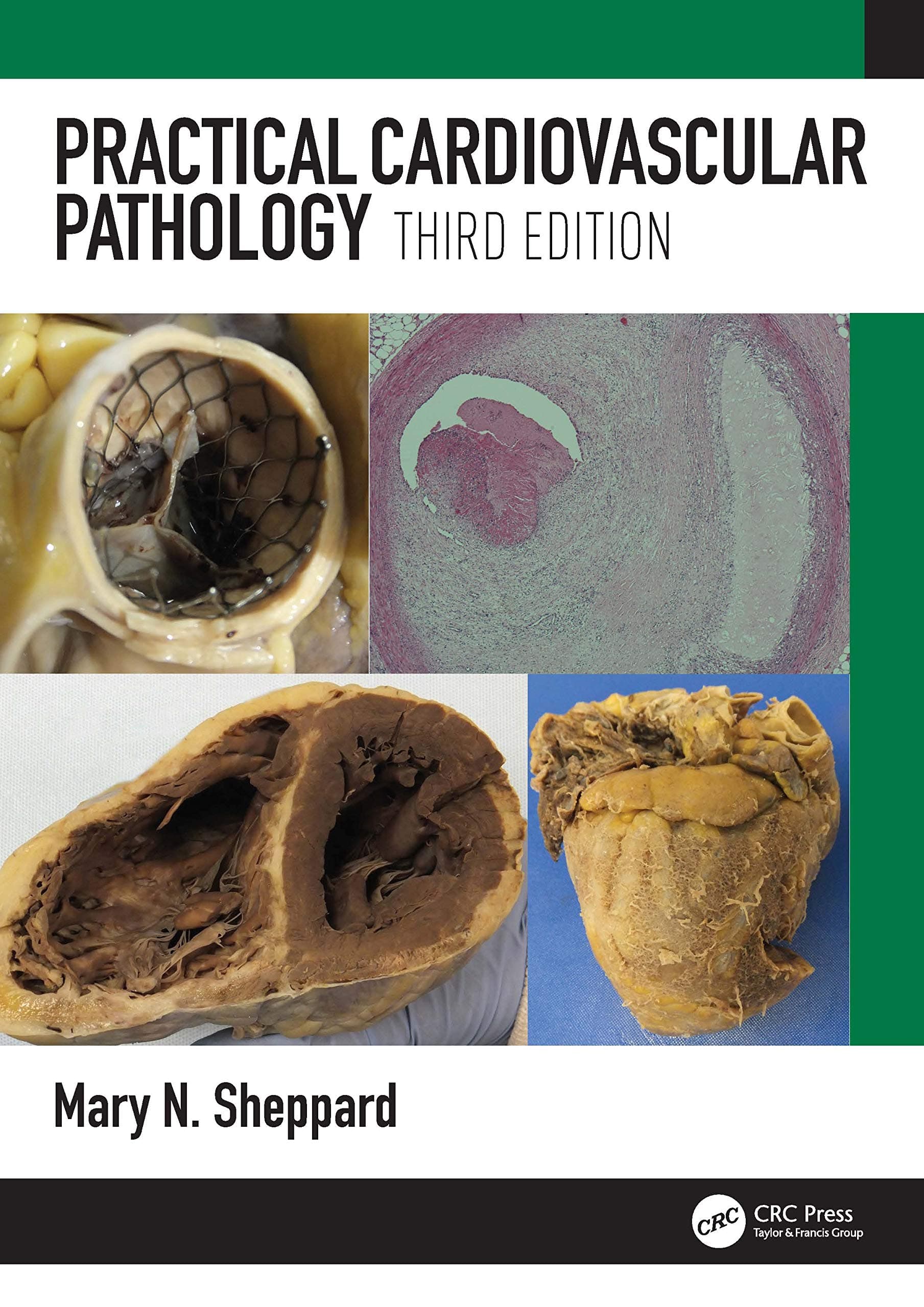 Practical Cardiovascular Pathology 3rd/2022
