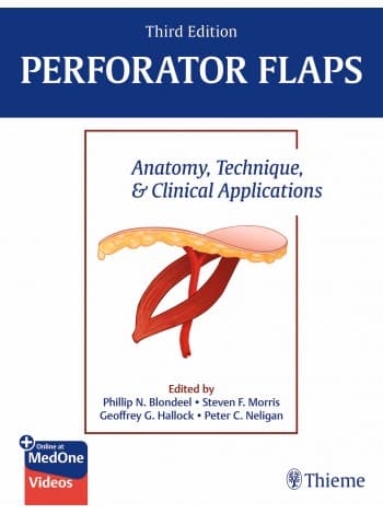 Perforator Flaps: Anatomy, Technique, & Clinical Applications 3rd/2024