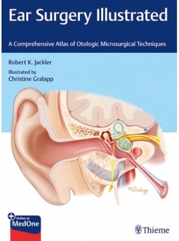 Ear Surgery Illustrated 1st/2019