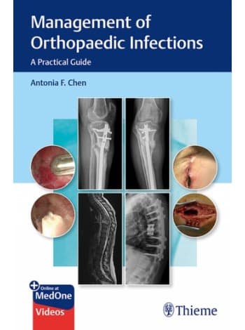 Management of Orthopaedic Infections 1st/2021