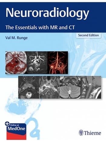 Neuroradiology 2nd/2020