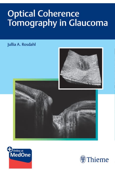 Optical Coherence Tomography in Glaucoma 1st/2021