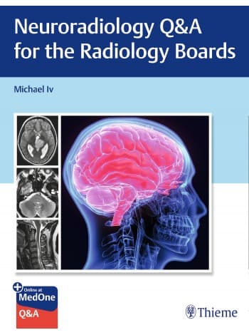 Neuroradiology Q&A for the Radiology Boards 1st/2023