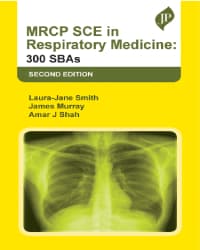 MRCP SCE in Respiratory Medicine: 300 SBAs 2nd/2023