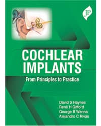Cochlear Implants From Principles to Practice 1st/2020