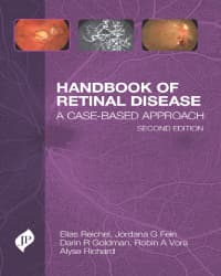 Handbook of Retinal Disease 2nd/2024