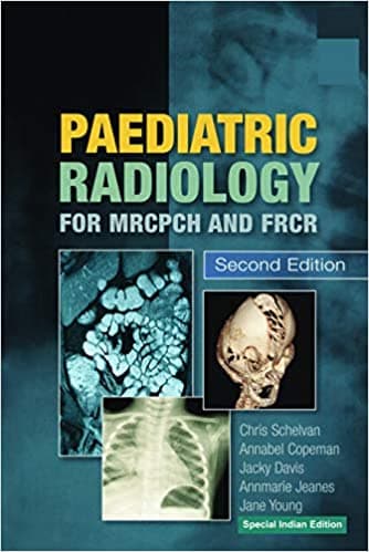 Paediatric Radiology for MRCPCH and FRCR 2nd /2012(Reprint 2021)