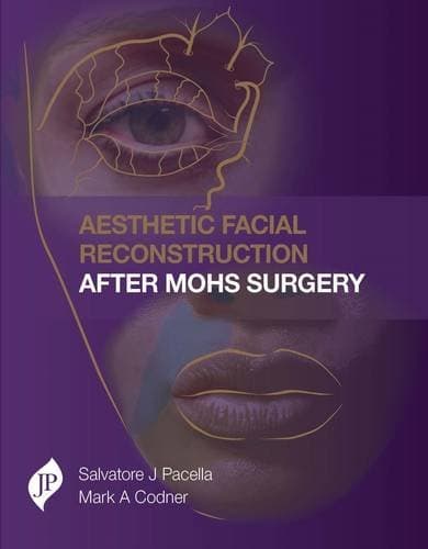 Aesthetic Facial Reconstruction After Mohs Surgery 1st/2017