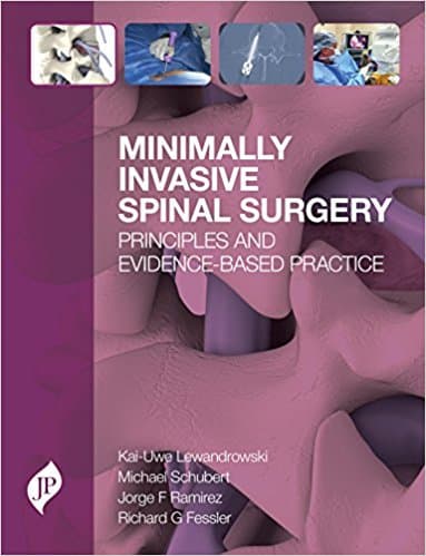 Minimally Invasive Spinal Surgery 1st/2018