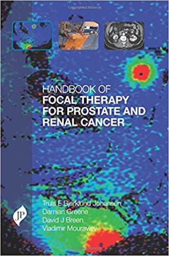 Handbook of Focal Therapy for Prostate and Renal Cancer 1st/2016