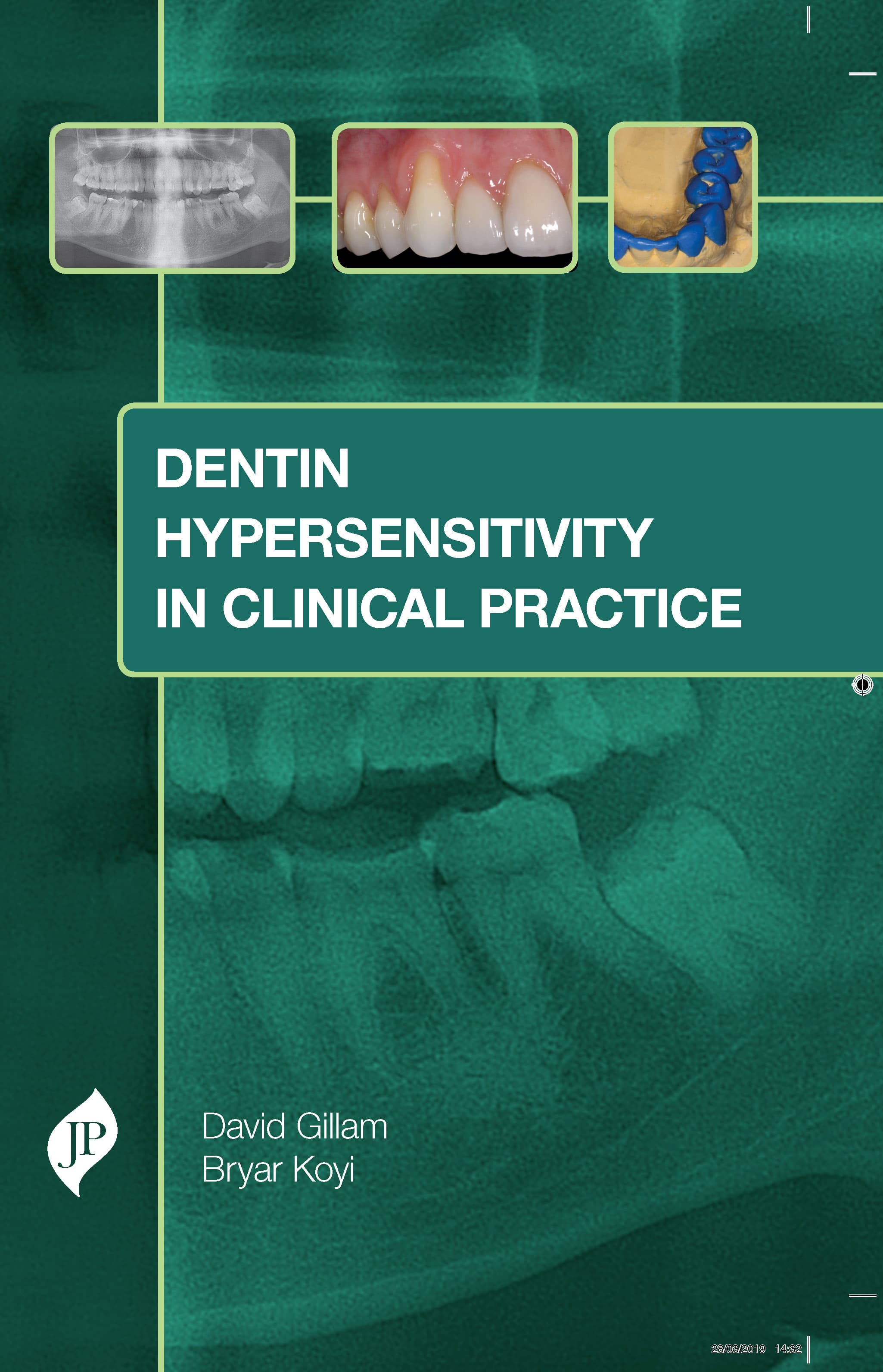 Dentin Hypersensitivity in Clinical Practice 1st/2020