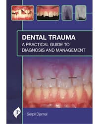Dental Trauma A Practical Guide to Diagnosis and Management 1st/2021