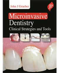 Microinvasive Dentistry Clinical Strategies and Tools 1st/2021
