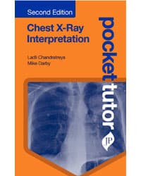 Pocket Tutor Chest X-Ray Interpretation 2nd/2019