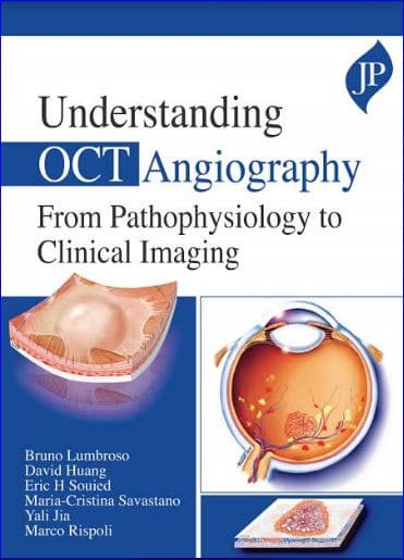 Understanding OCT Angiography 1st/2020