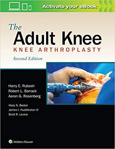 The Adult Knee: Knee Arthroplasty 2nd/2020