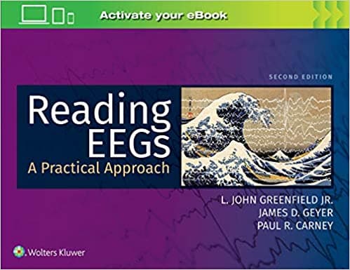 Reading EEGs: A Practical Approach 2nd/2021