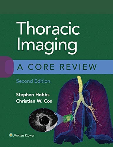 Thoracic Imaging A Core Review 2nd/2021