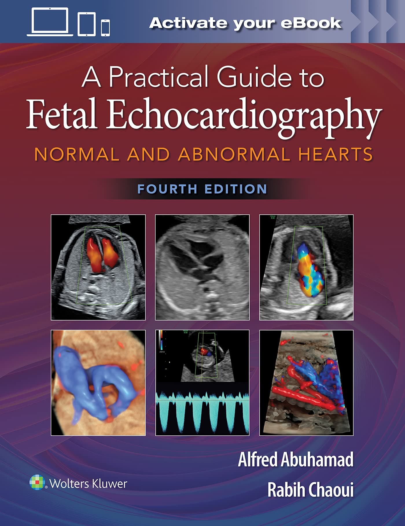 Practical Guide to Fetal Echocardiography 4th/2022