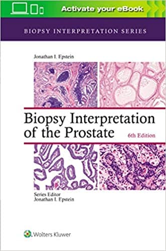 Biopsy Interpretation of the Prostate 6th/2020