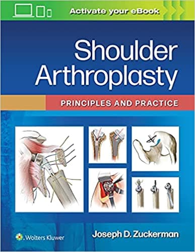 Shoulder Arthroplasty Principles and Practice 1st/2022