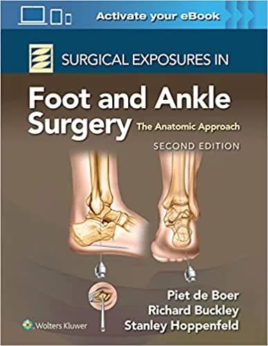 Surgical Exposures in Foot and Ankle Surgery 2nd/2023